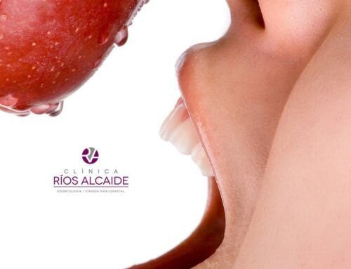 5 Tips de higiene dental con brackets