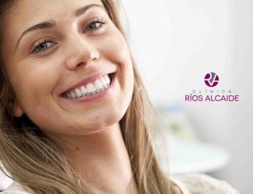Carillas dentales sin tallado: Sistema Diveneers