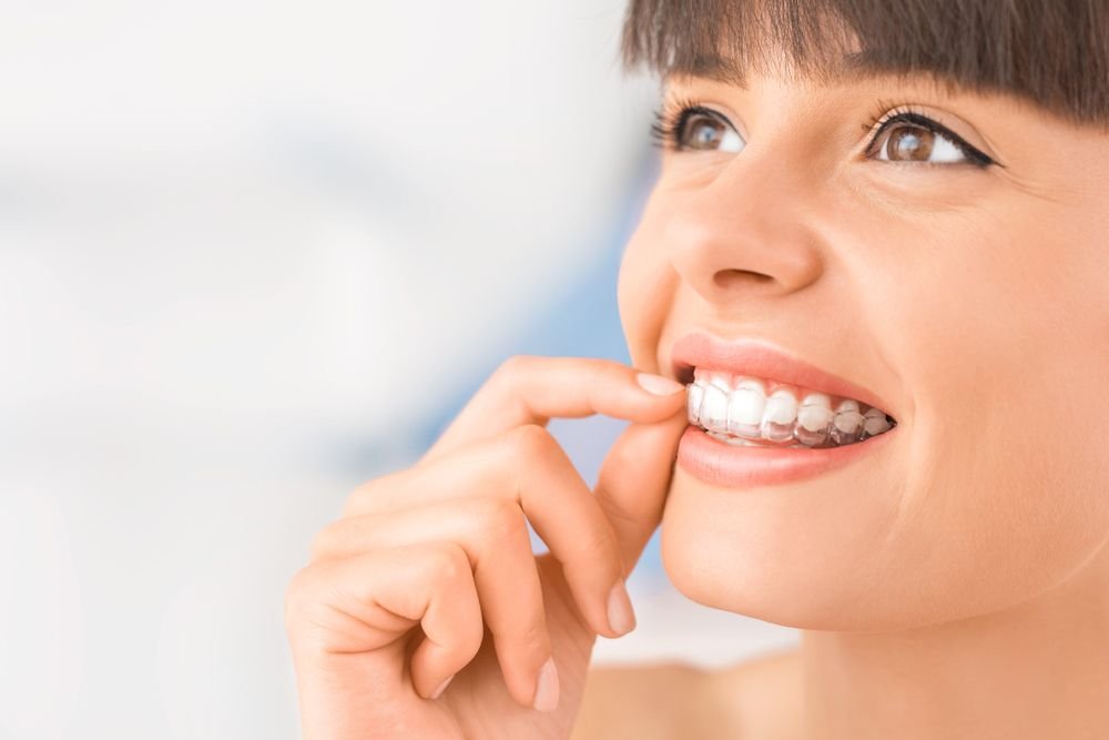 férulas dentales