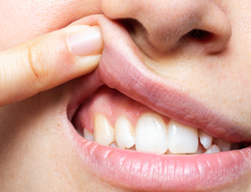 Encías retraídas: por qué los dientes parecen más largos y cuándo conviene revisarlo