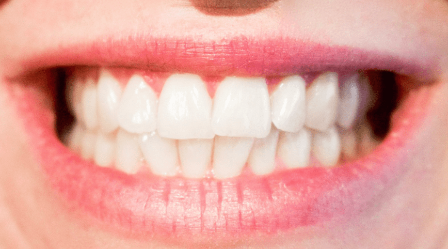 mordida dental écija