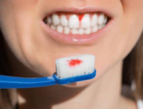 ¿Por qué me sangran las encías al cepillarme? Cuándo deja de ser algo puntual